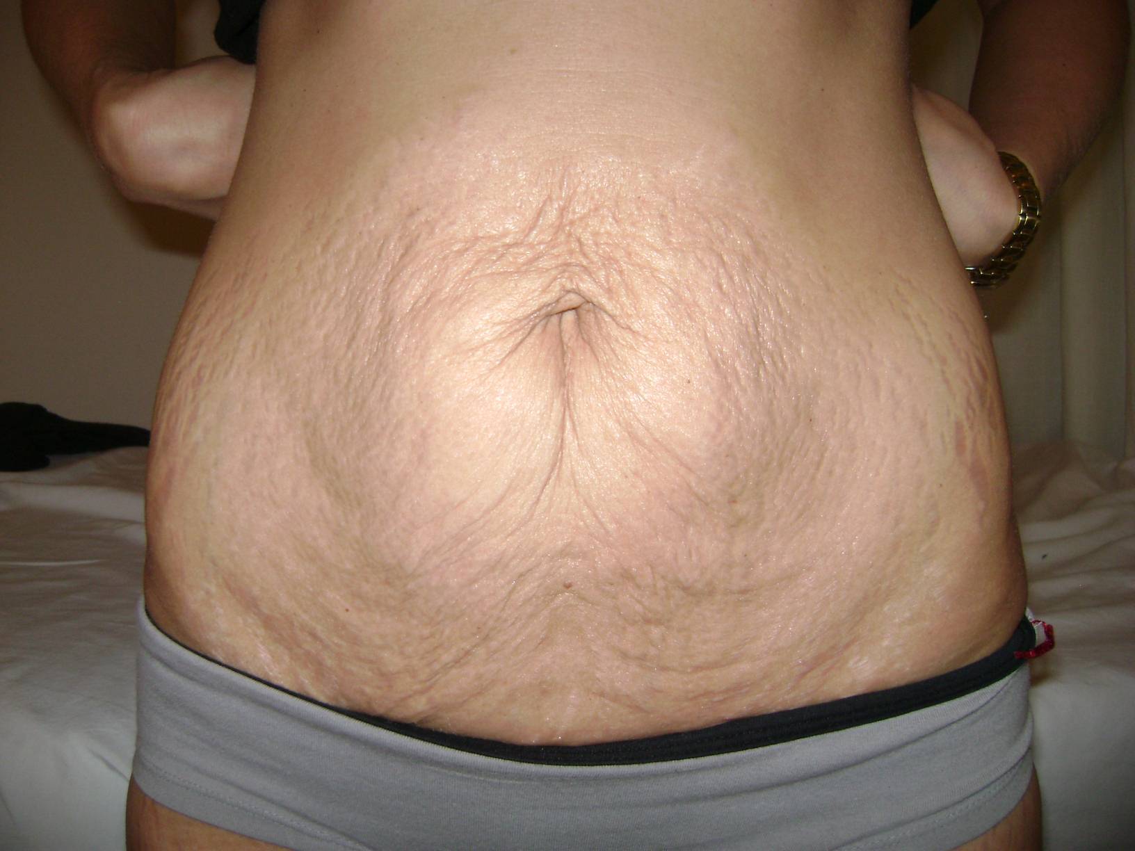 грудь после родов у женщин фото 54