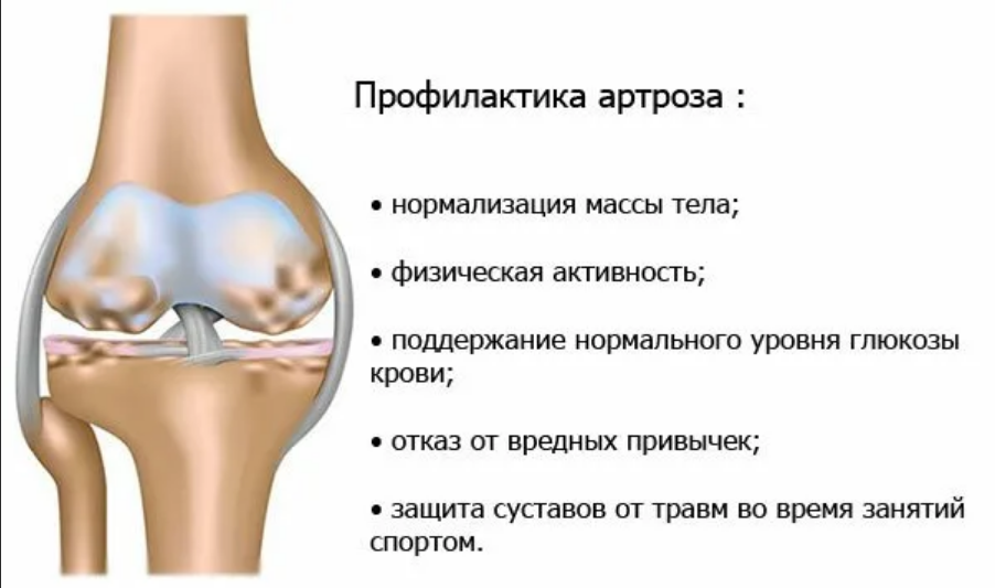 Крепитация в коленных суставах - kinesiopro