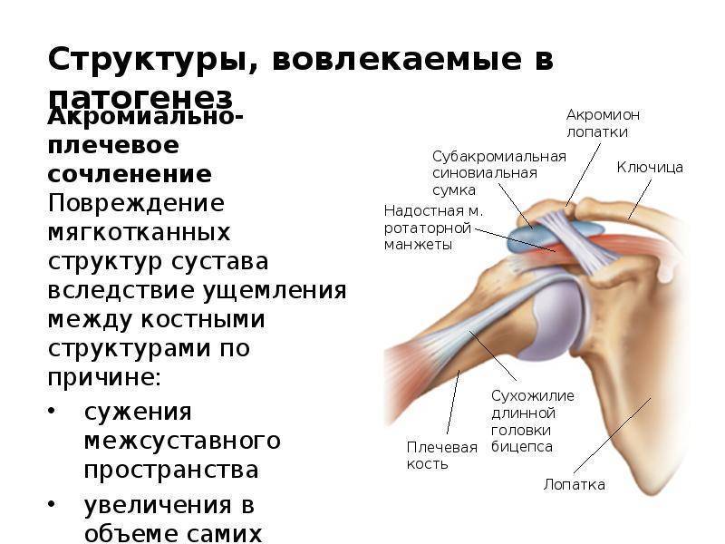 Симптомы патологии плеча