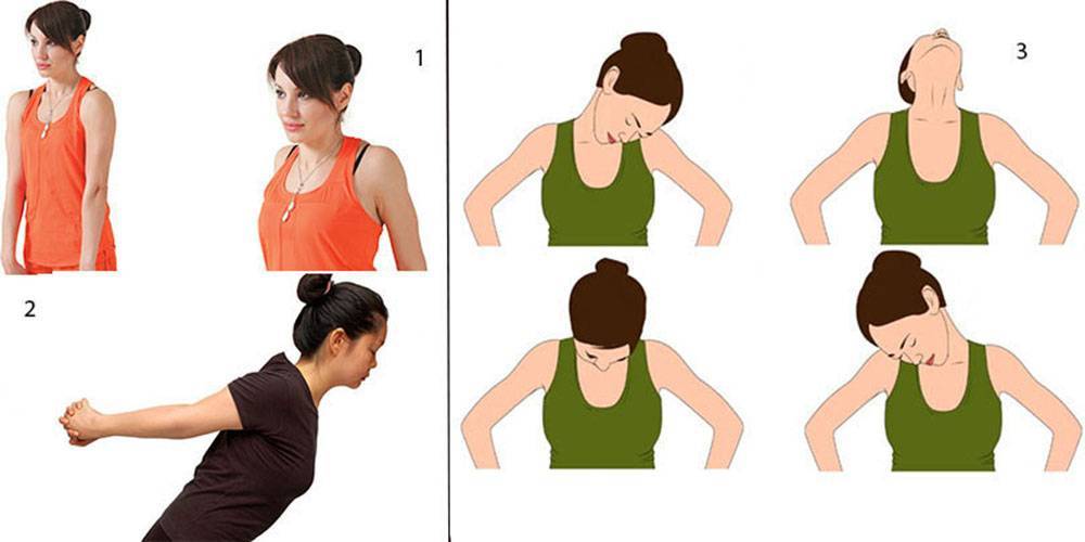Лфк при шейном остеохондрозе: 16 действенных упражнений, правила тренировок