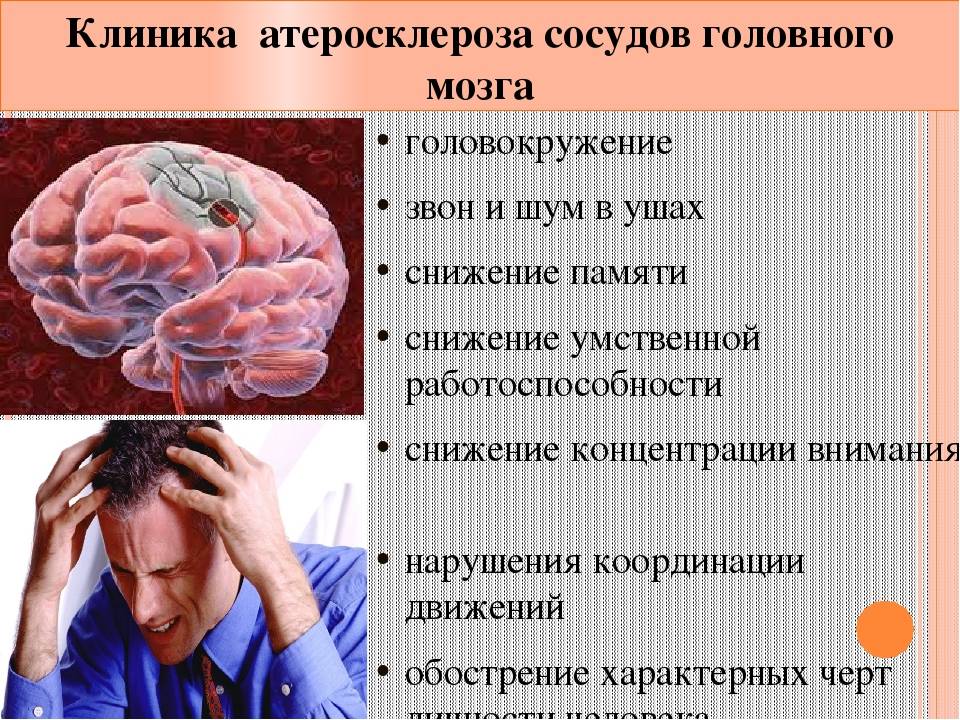 Головокружение снижение памяти. Атеросклероз сосудов головного мозга. Атеросклероз артерий головного мозга. Клинические проявления атеросклероза мозговых артерий. Атеросклероз сосудов головного мозга симптомы.