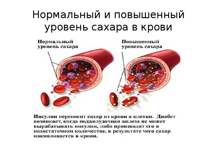 Норма глюкозы в крови