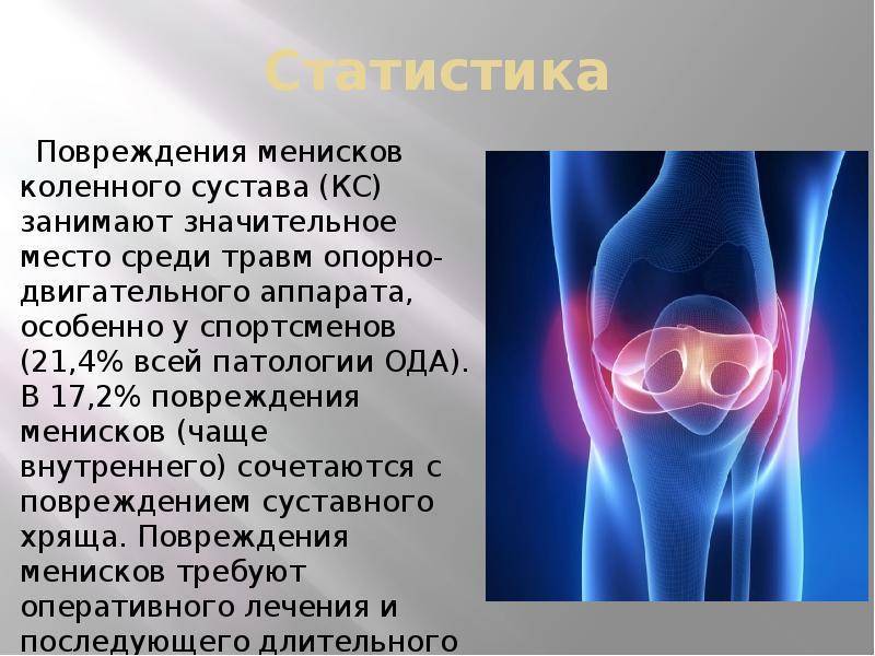 Лечение разрыва мениска коленного. Разрыв мениска коленного сустава. Травма мениска коленного сустава симптомы. Повреждение мениска коленного сустава симптомы. Повреждение менисков коленного сустава.
