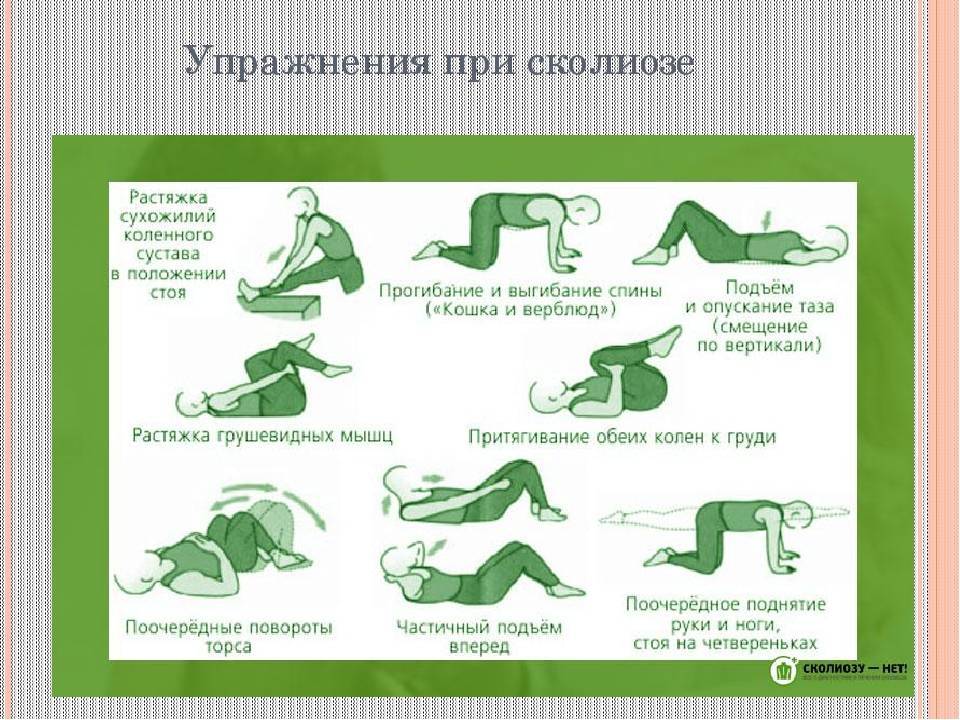 Упражнения при сколиозе | сеть клиник «здравствуй!»