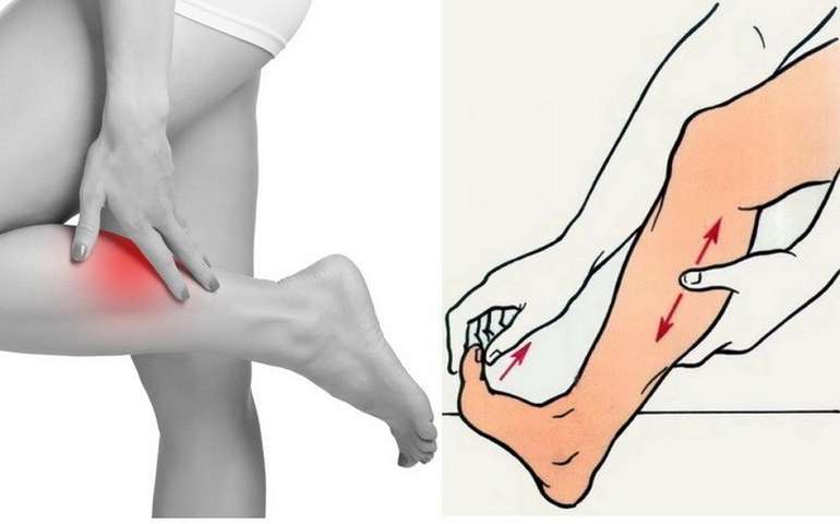 Сводит ногу судорогой в икре: причины, лечение и профилактика