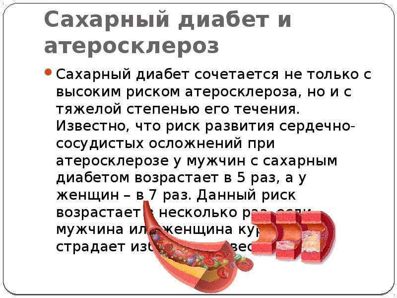 Диабет и спорт